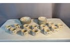 Property photo 178 - TIMED ONLINE ONLY - PERSONAL PROPERTY AUCTION - ALLEN COUNTY, INDIANA